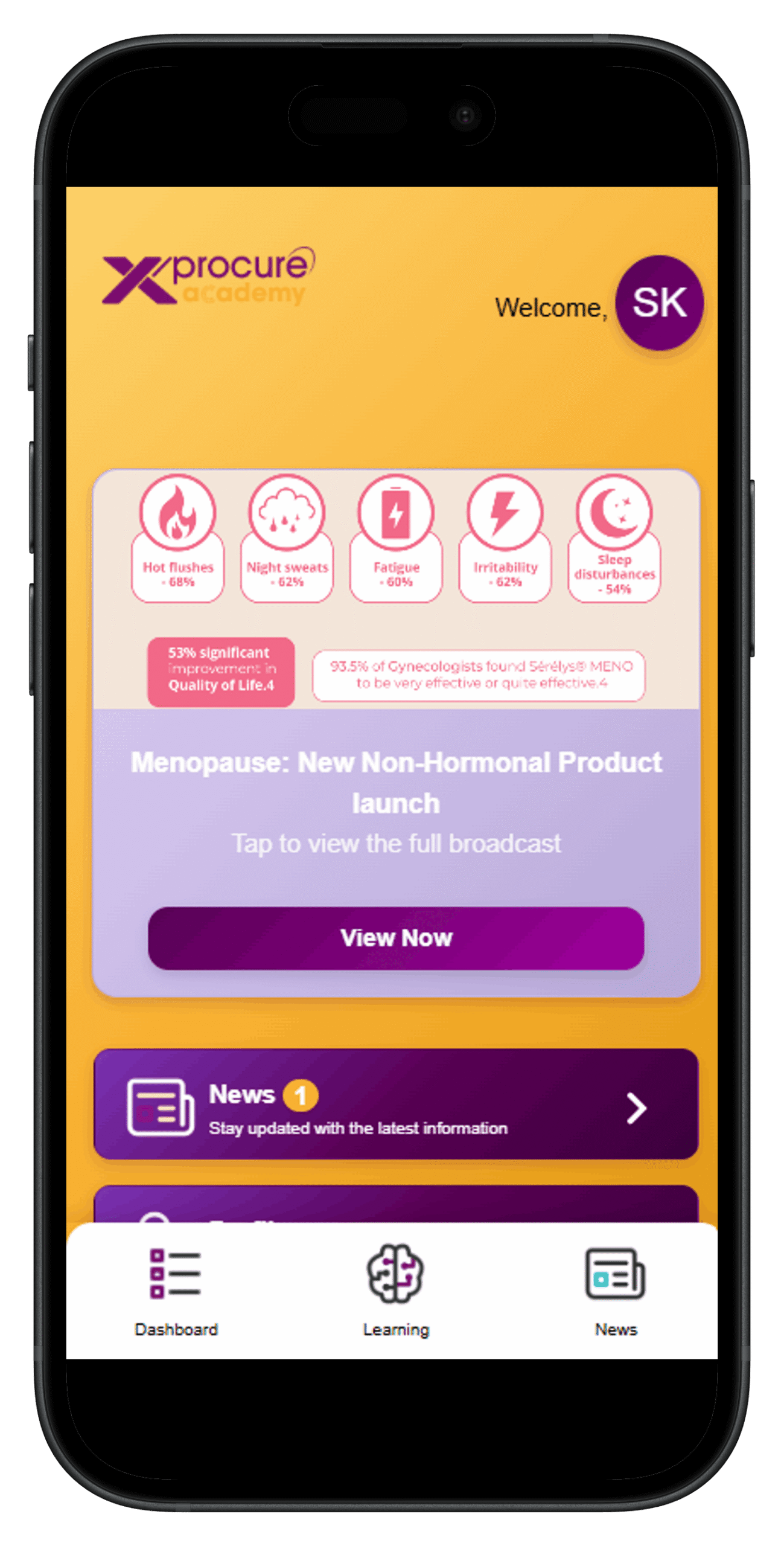 xprocure-app-south-africa-cnnect